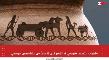 إشارات التصلب اللويحي قد تظهر قبل 15 عاماً من التشخيص الرسمي